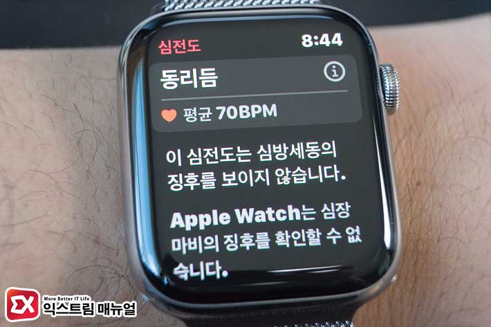 How To Activate The Apple Watch Ecg 6
